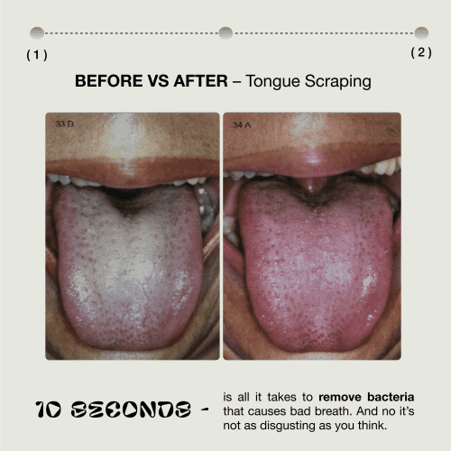 Beforeandaftertonguescraper